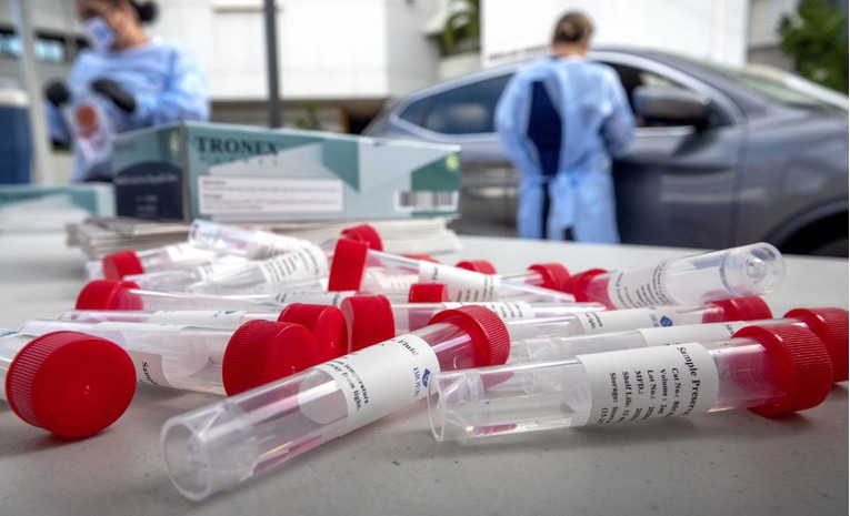 Slovenski epidemiolozi strahuju zbog stanja u Italiji, Mađarskoj i susjedstvu