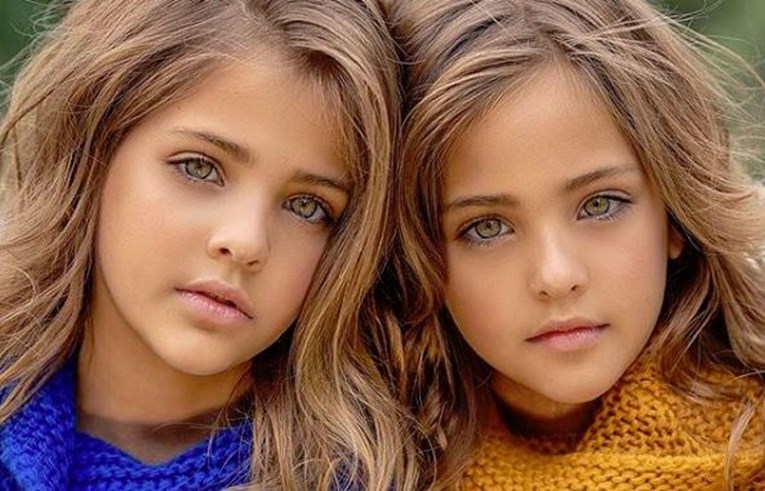 FOTO Najljepše blizanke na svijetu imaju 9 godina i više od 1,1 milijun fanova