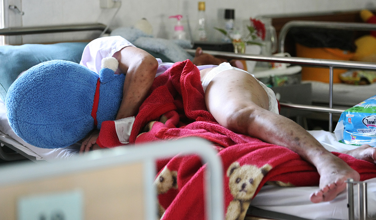 Epidemija zaraze HIV-om u istočnoj Europi. Kakvo je stanje u Hrvatskoj?