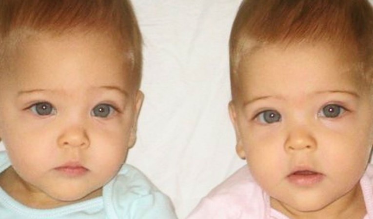 Evo kako danas, devet godina kasnije, izgledaju najljepše blizanke na svijetu