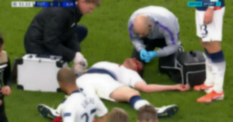 FOTO Tottenhamov stoper završio u krvi poslije žestokog sudara