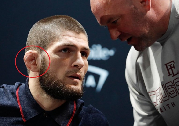 Zašto Khabib ima izobličeno uho?