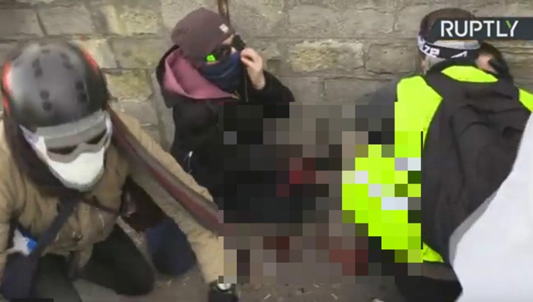 UZNEMIRUJUĆE Prosvjednik u Parizu ostao bez ruke u krvavom sukobu s policijom