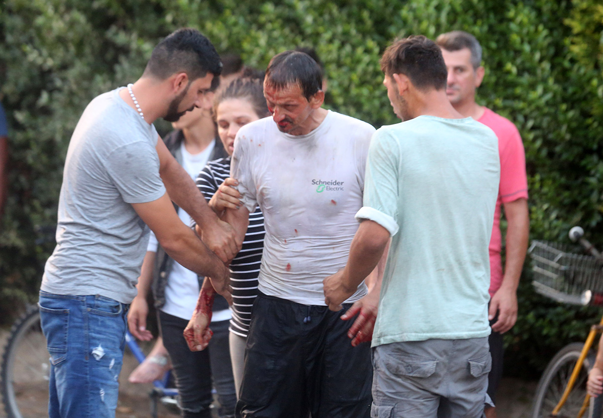 Muškarac si razrezao ruku pred Bandićem