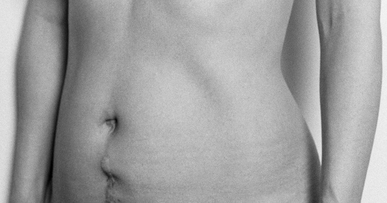 Mara Bratoš golim fotografijama pokazala kako zaista izgleda tijelo u trudnoći