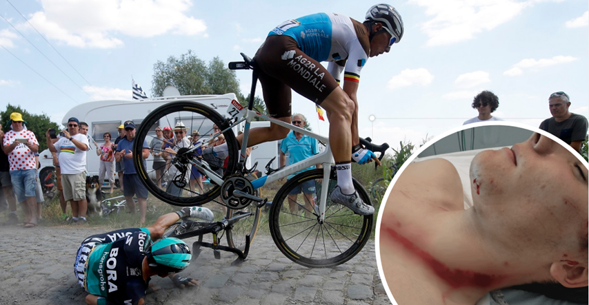 UZNEMIRUJUĆE Biciklist se teško ozlijedio na ogradi koja mu je spasila život