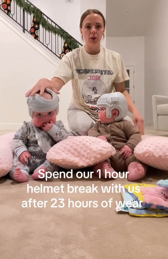 Što je plagiocefalija i zašto bebe nose kacige za oblikovanje glave?