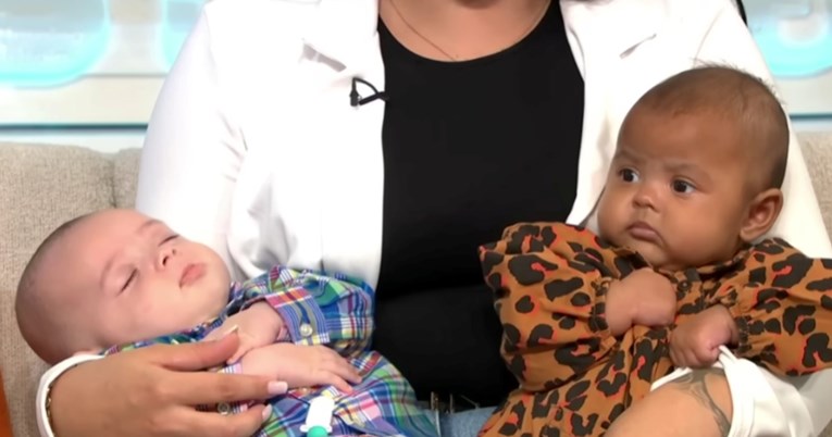 Žena pokazala blizance različite boje kože i izazvala trolove: Varala si supruga?