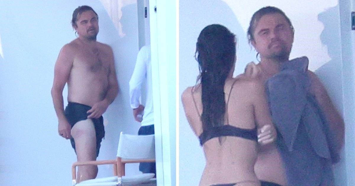 DiCaprija tijekom odmora u Italiji opekla meduza, djevojka (26) mu priskočila u pomoć