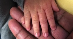 Djevojčica se rodila s 12 prstiju na rukama pa trolovi mami poručili da ih "otkine"