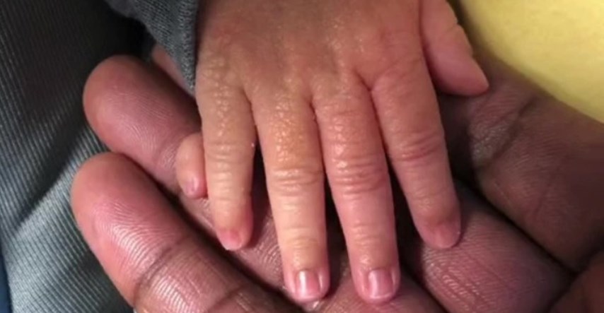Djevojčica se rodila s 12 prstiju na rukama pa trolovi mami poručili da ih "otkine"