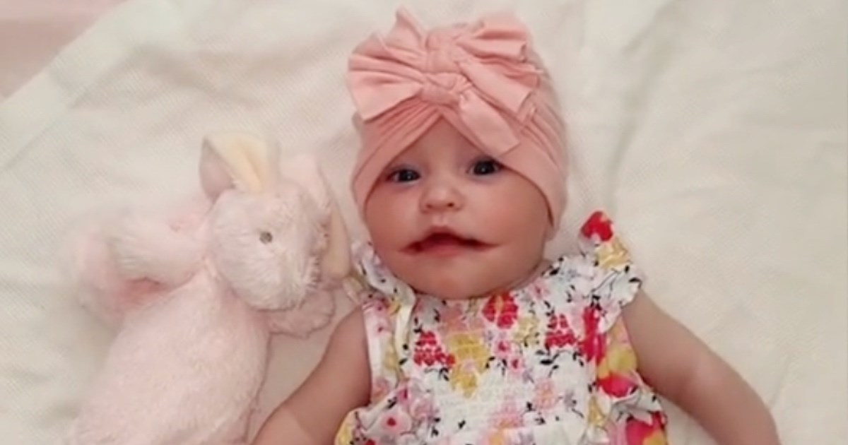 Curica rođena s trajnim osmijehom jedna je od 14 osoba na svijetu s rijetkim stanjem