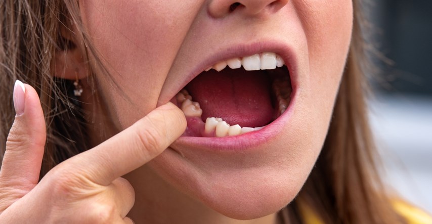 Ortodont upozorava: Nedostatak sna može povećati rizik od gubitka zuba