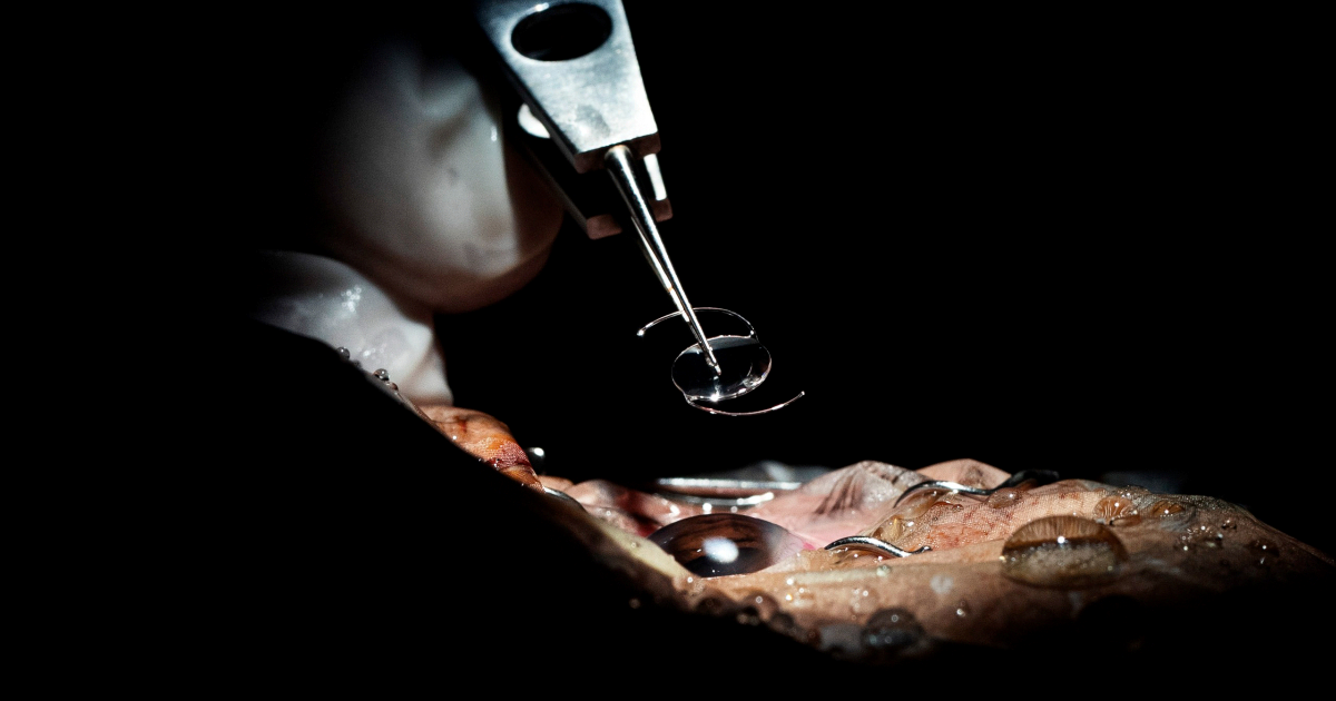 Liječnici u Londonu revolucionarnom injekcijom gela vraćaju vid