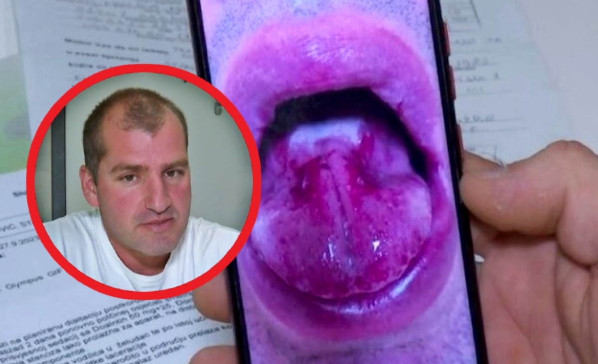I Stanku je prije pola godine spaljen jednjak. Odvjetnica: Isto je popio Romerquelle