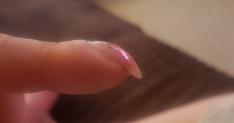 Jedan pogled na nokte mogao bi pomoći u otkrivanju ranih znakova raka pluća