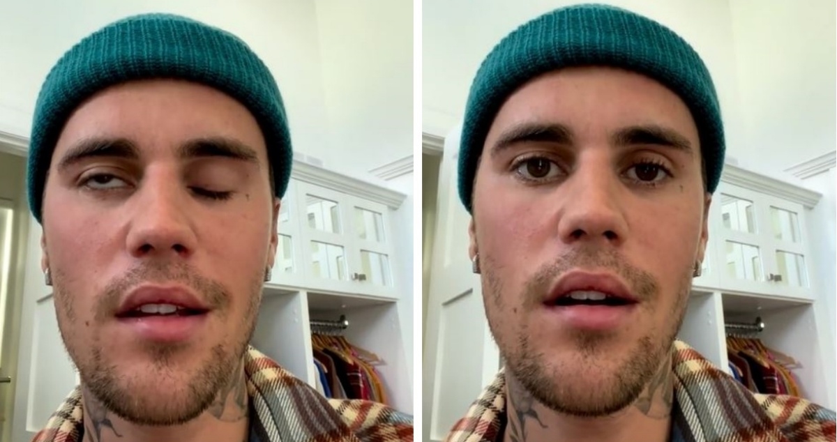 Justin Bieber otkazao nastupe zbog bolesti: Pola lica mi je potpuno paralizirano