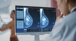 Istraživanje: Veliki broj žena u Hrvatskoj ne zna da može utvrditi rizik od raka