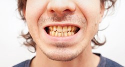 Stomatolog: Za ovu svakodnevnu naviku ni ne slutite da je loša za zube