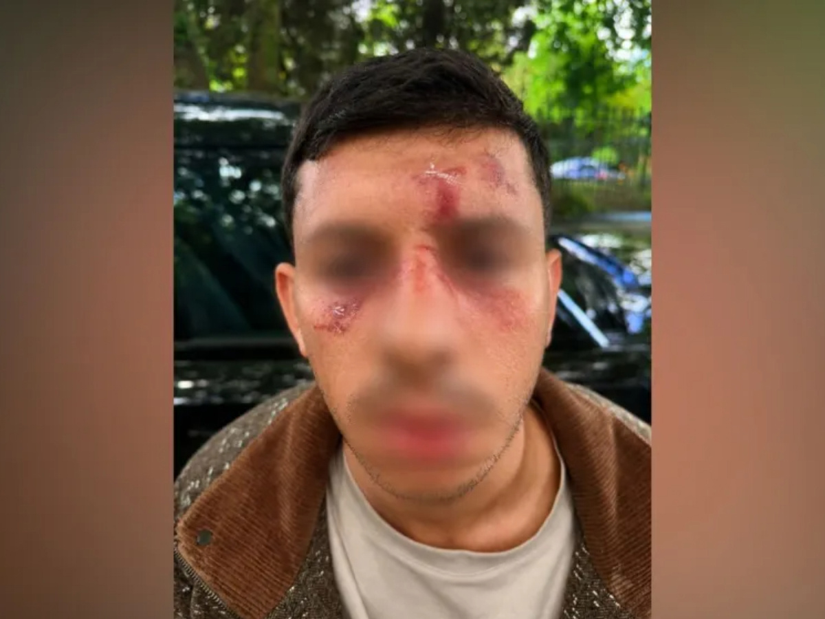 Mladi Židov napadnut u Londonu. "Udarali su me kao životinju"
