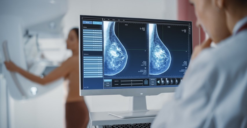 Znanstvenici: AI otkrio rak dojke prije nego dva liječnika s mamogramom