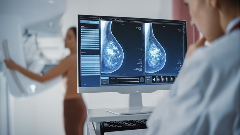 Znanstvenici: AI otkrio rak dojke prije nego dva liječnika s mamogramom