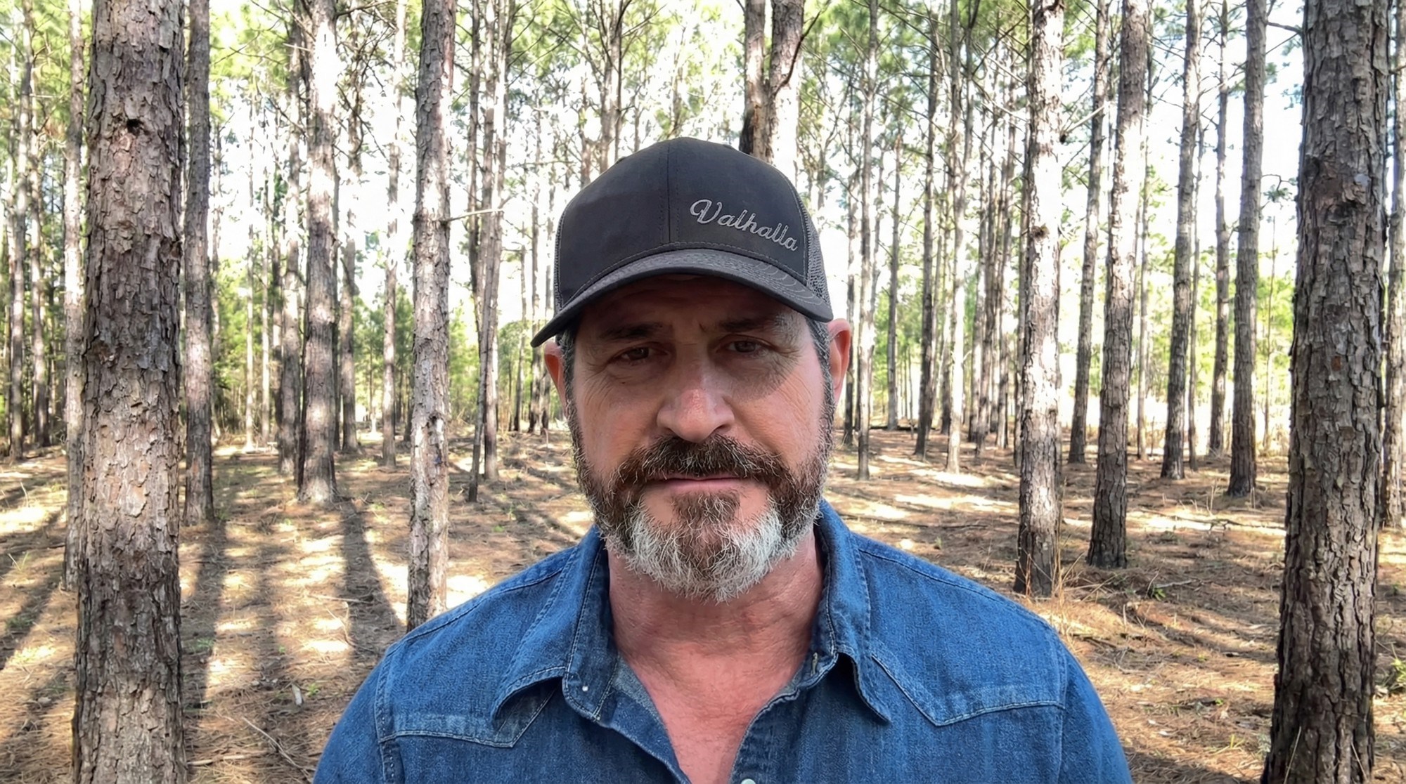 Kardiolog koji je preživio infarkt upozorio na znak koji mnogi ignoriraju