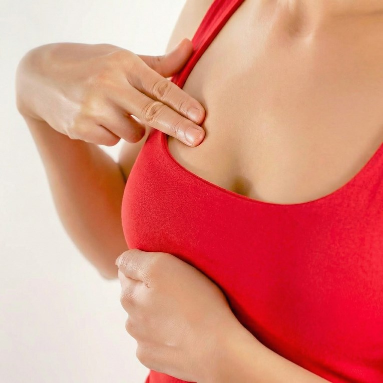 Kako izvesti samopregled dojki