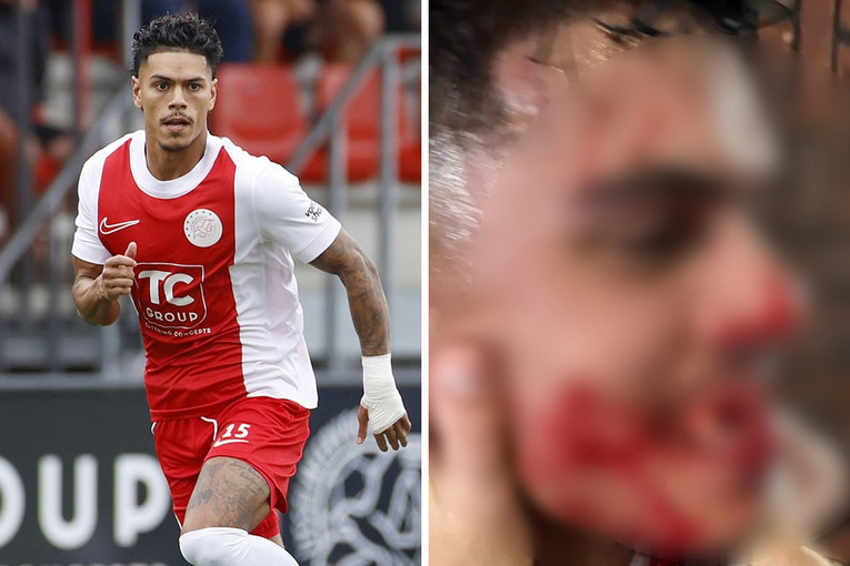 UZNEMIRUJUĆA FOTOGRAFIJA Trener u Nizozemskoj nokautirao igrača, izbio mu sedam zuba
