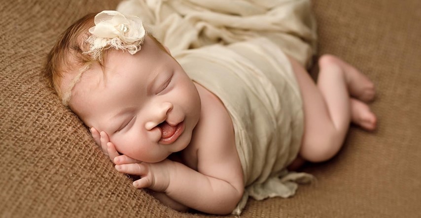 700 tisuća lajkova: Fotografija bebe rođene s rascjepom usne postala je viralna