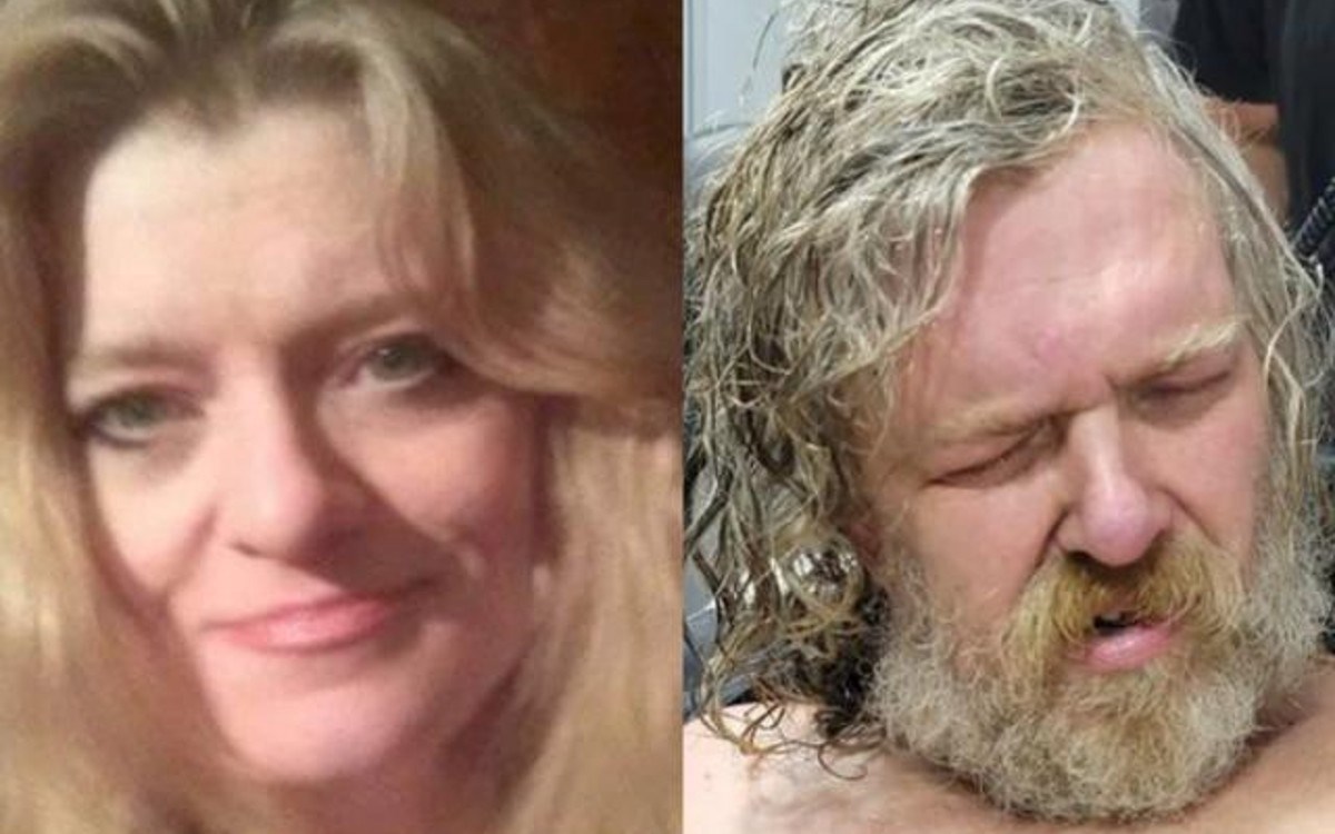 Amerikanka nakon dvije godine u komi identificirala svog brata kao napadača