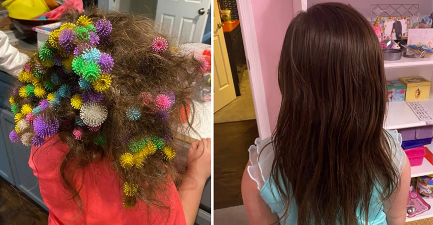 Mama provela 20 sati uklanjajući 150 čičaka iz kose šestogodišnje kćeri