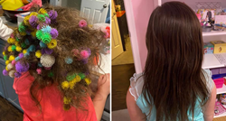 Mama provela 20 sati uklanjajući 150 čičaka iz kose šestogodišnje kćeri