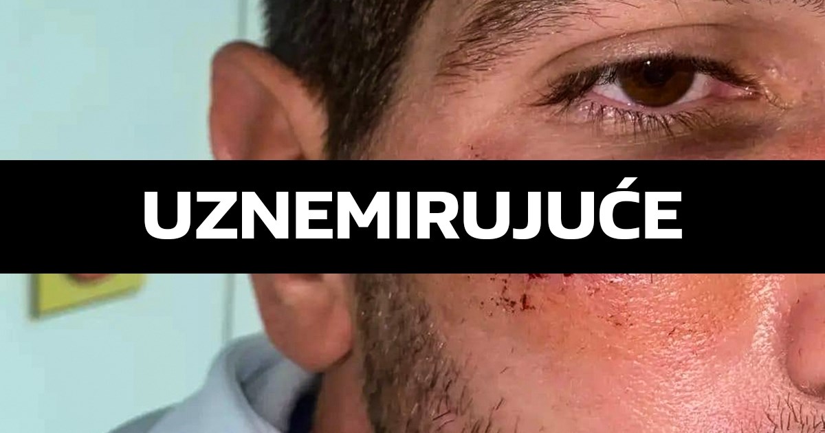 Slaven objavio fotografiju ozljede svog igrača: "Prosudite sami je li za crveni"