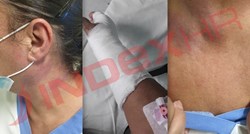 Liječnik brutalno napao i teško ozlijedio medicinsku sestru zbog ispričnice za sina