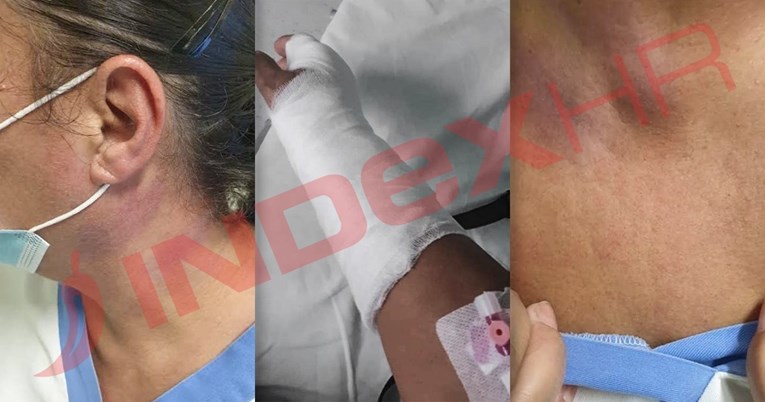 Liječnik brutalno napao i teško ozlijedio medicinsku sestru zbog ispričnice za sina