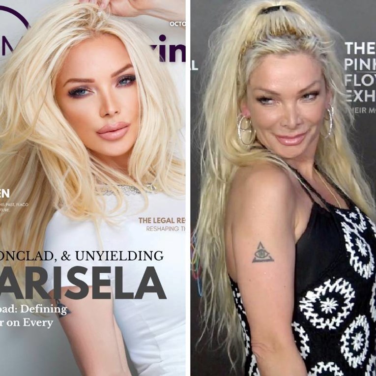 Nećete vjerovati, na obje fotke je ista osoba 🫣