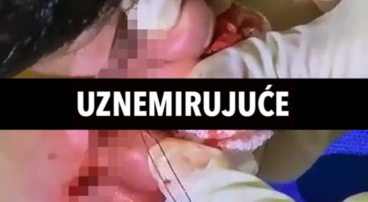 UFC borac pokazao ozljedu: Jedan od mojih najvećih strahova postao je realnost