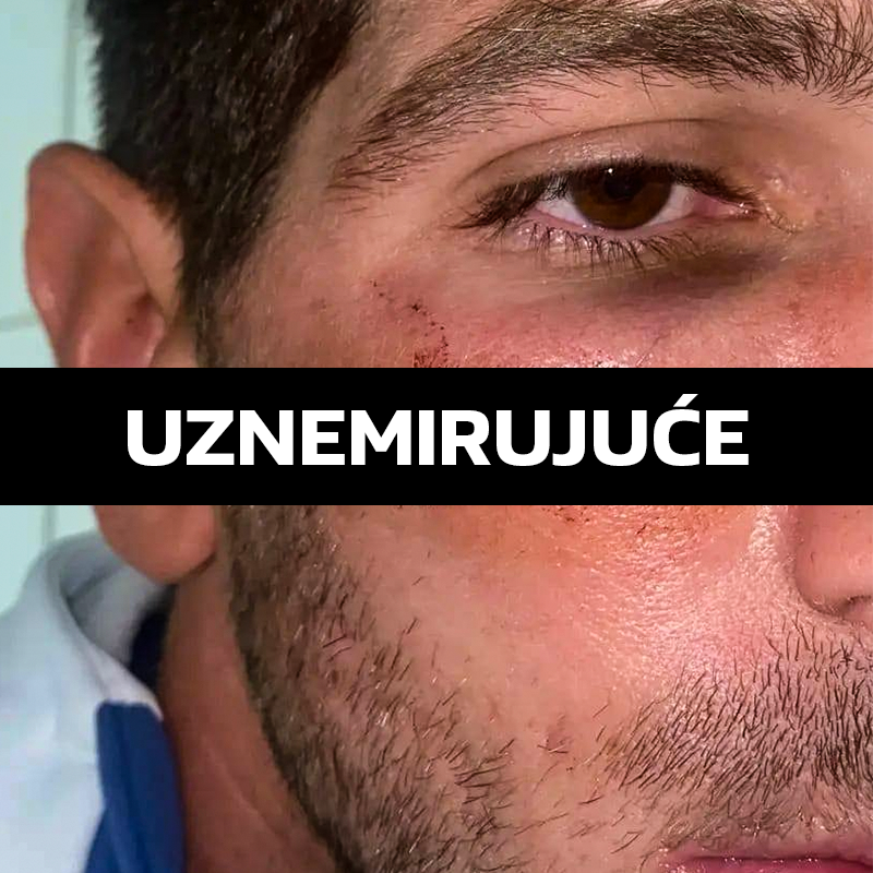 Slaven objavio fotografiju ozljede svog igrača: "Prosudite sami je li za crveni"