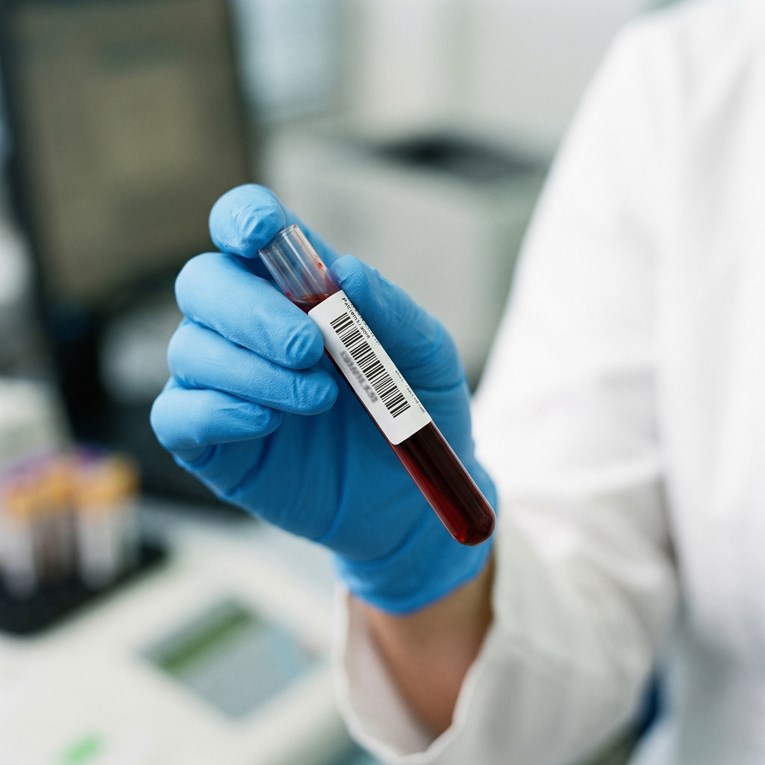 Jedna krvna grupa nosi veći rizik od dijabetesa tipa 2