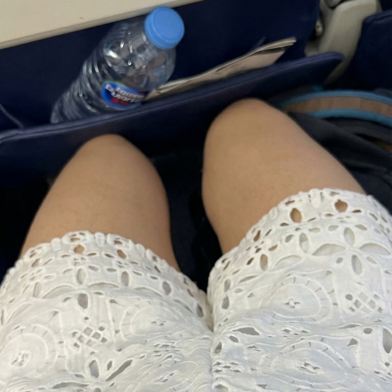 Putnica pokazala zašto ne biste trebali nositi kratke hlače u avionu