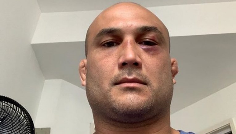 Legendarni UFC borac doživio nokaut u uličnoj tučnjavi