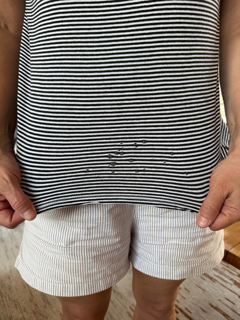 Ljudi otkrili uzrok misterioznih rupica na majicama koje izluđuju mnoge