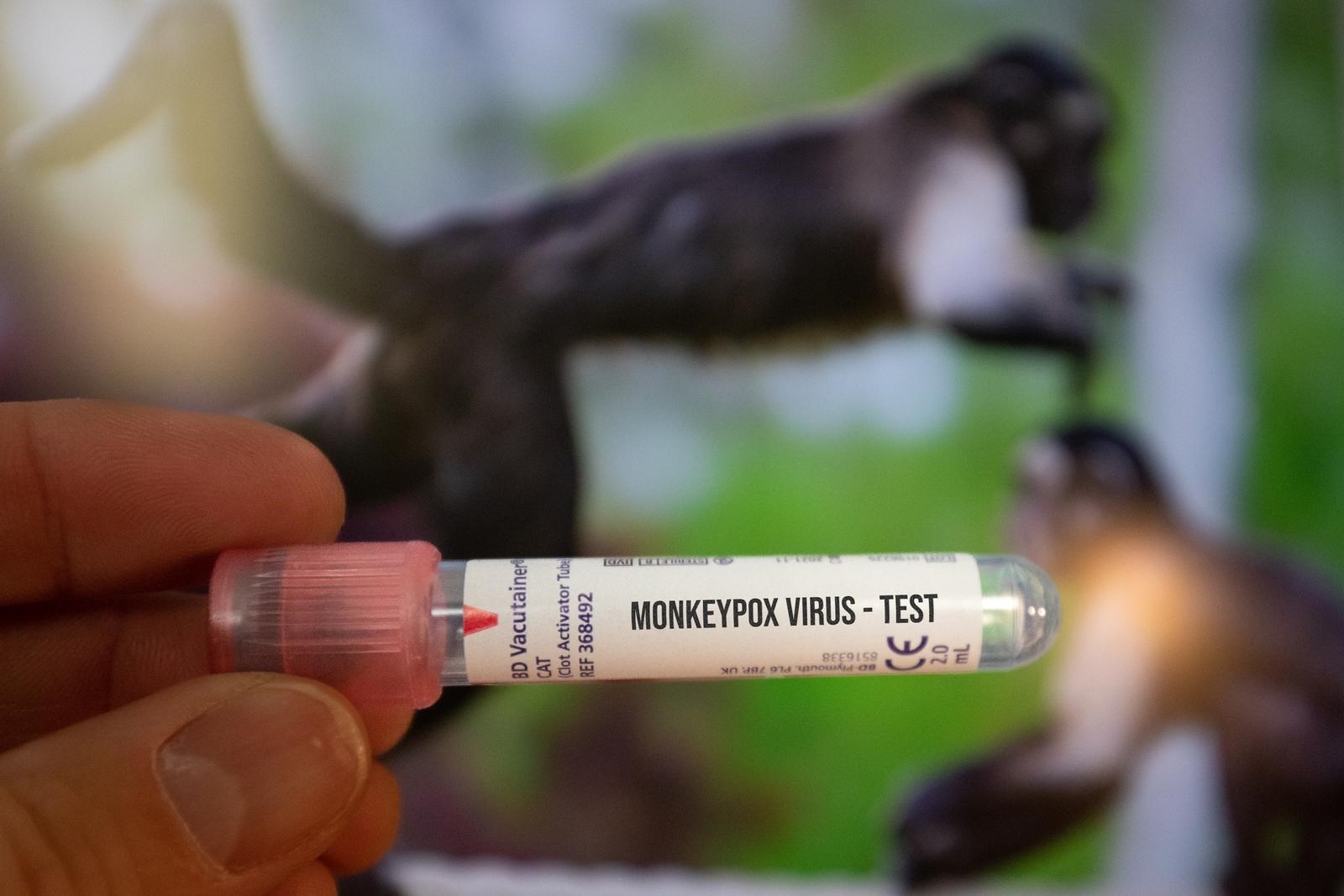 WHO kaže da epidemija majmunskih boginja usporava u Europi