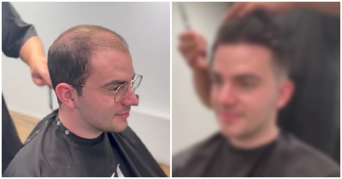 Frizer pokazao transformaciju proćelavog dečka, ljudi pišu: "Ovo nije ista osoba"