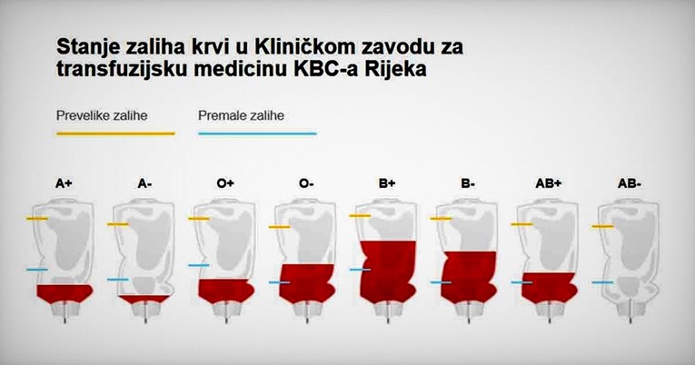 Apel riječke bolnice: Hitno nam trebaju neke krvne grupe