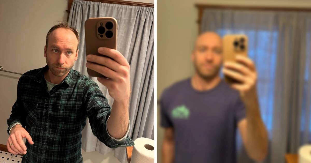 Počeo ćelaviti pa obrijao glavu, rezultat oduševio mnoge