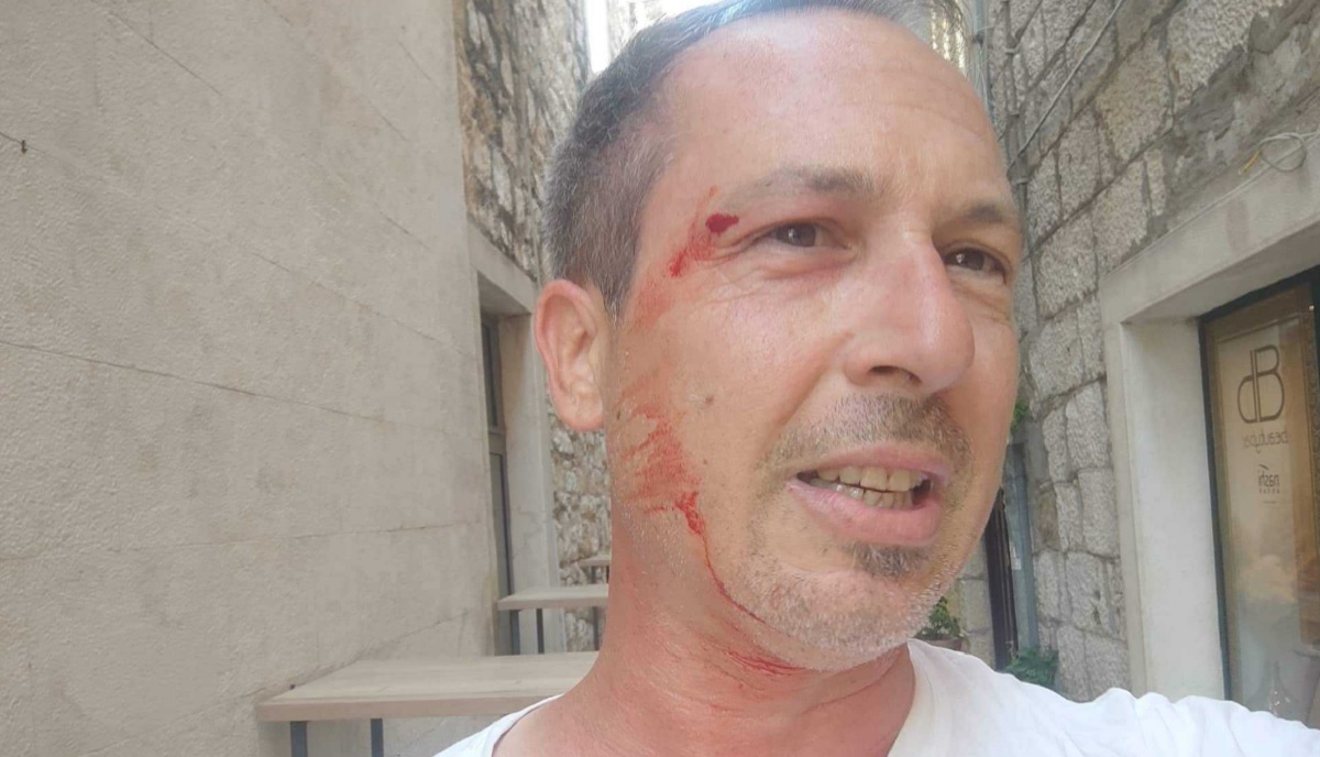 Makaranin kaže da ga je vlasnik psa nokautirao. Policija prijavila obojicu