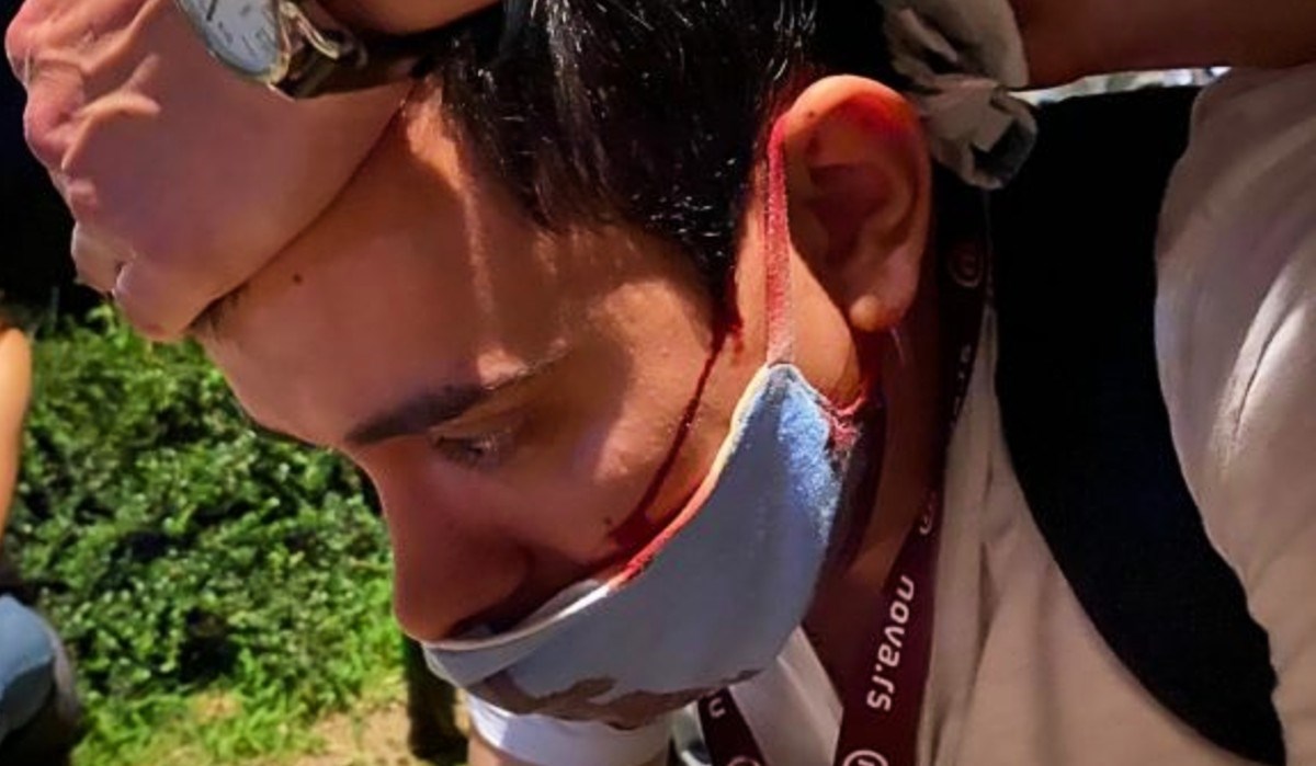 VIDEO Maskirani tipovi u Beogradu razbili glavu novinaru, ovo je trenutak napada