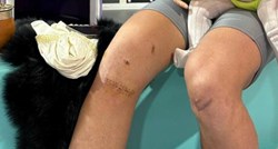 FOTO Ovo su koljena nekadašnje Barcine nade kojoj su karijeru uništile ozljede